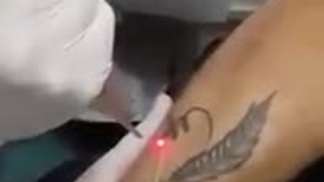 Как да премахнем татуировка - Видео Урок