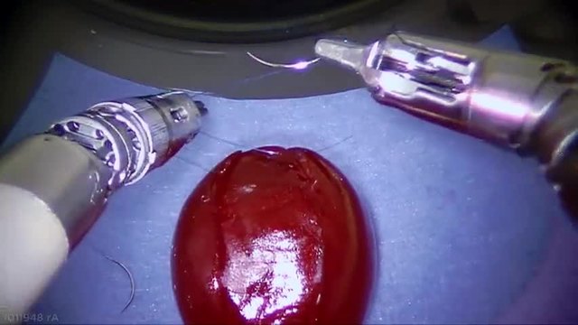 Хирургически робот прецизно зашива зрънце от грозде (ВИДЕО)